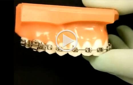 Emergency care video Ragan Orthodontics in Dallas, TX